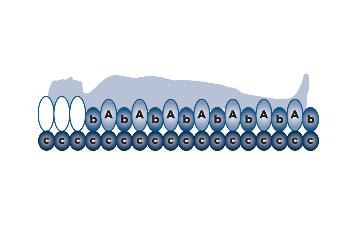 Alerta Ruby Turn Lateral Turning Replacement Alternating Mattress System, Very High Risk